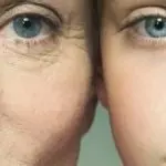 Какво е Гликация? Как да се чувстваме и изглеждаме по-млади