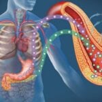 Инсулинова Резистентност – Складиране на Мазнини около Органите и Подкожни Мазнини